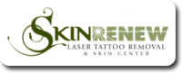 Skin Renew Laser Tattoo Removal